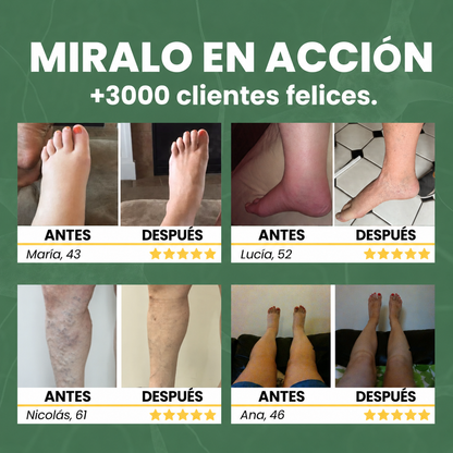Bálsamo Milagroso - Efecto Frío para Piernas Cansadas Hecho en Argentina
