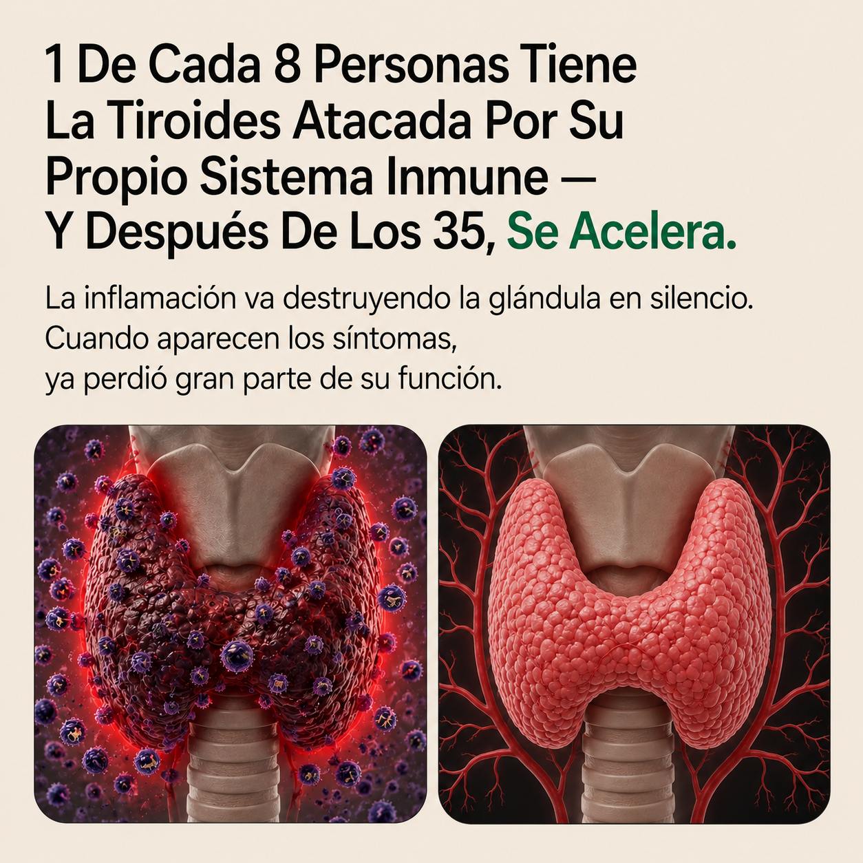 Cápsulas de Soporte para la Tiroides by Zent™