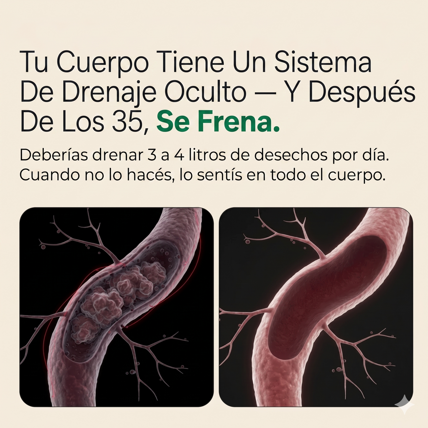 Nueva Fórmula de Máxima Concentración — Cápsulas de Drenaje Linfático by Zent™